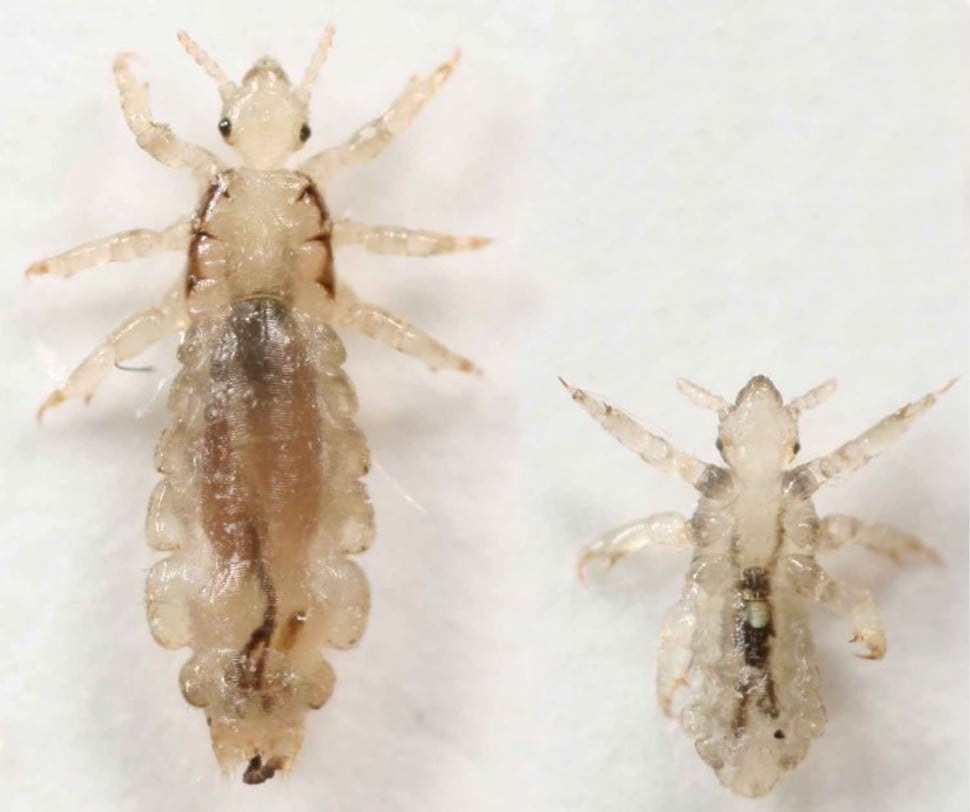 Can You Freeze Lice
