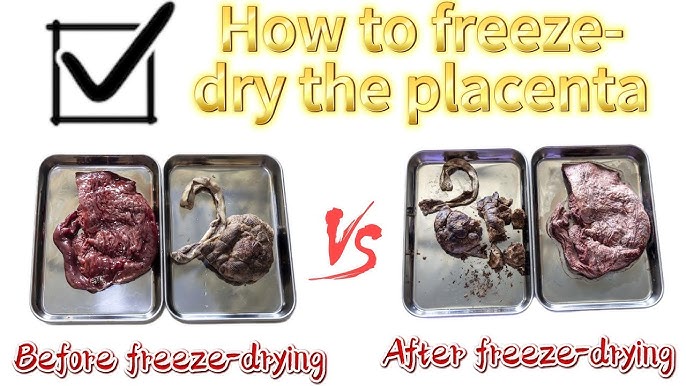 Can You Freeze Your Placenta