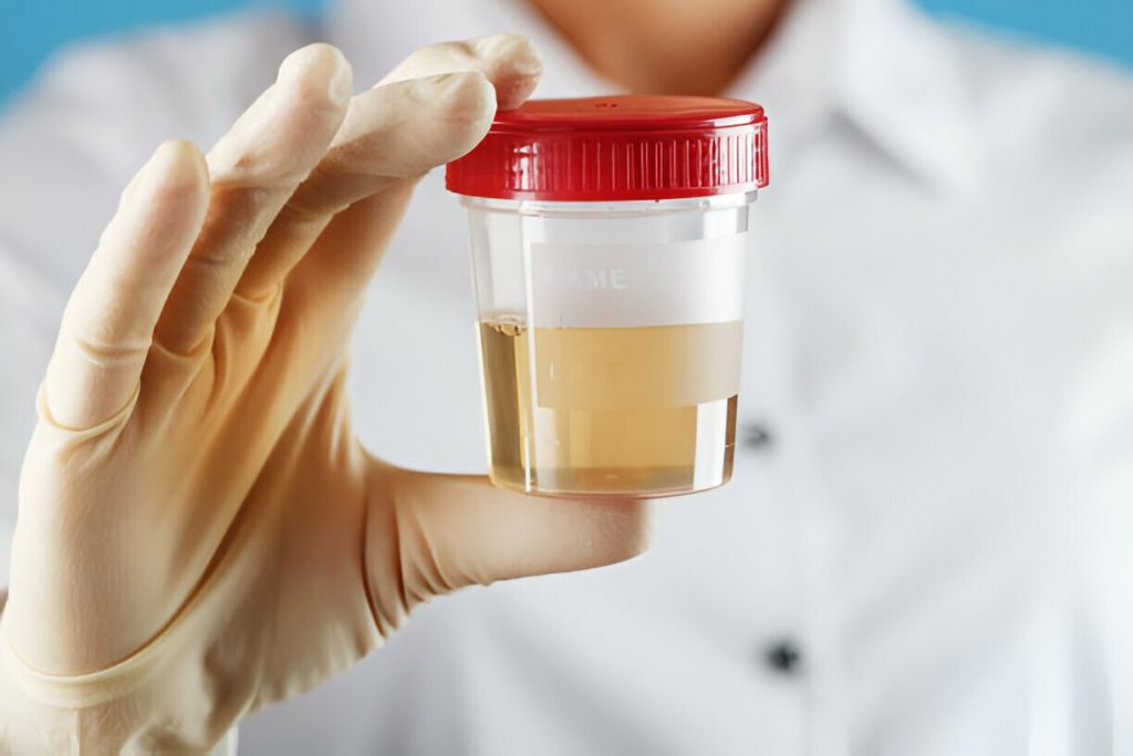 Do Urine Specimens Need to Be Refrigerated
