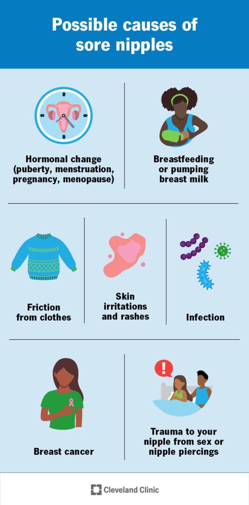 Does Breast Pumping Hurt