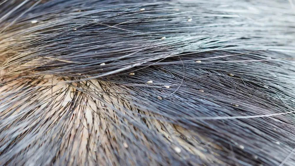How Long Can Lice Live in Freezing Temperatures