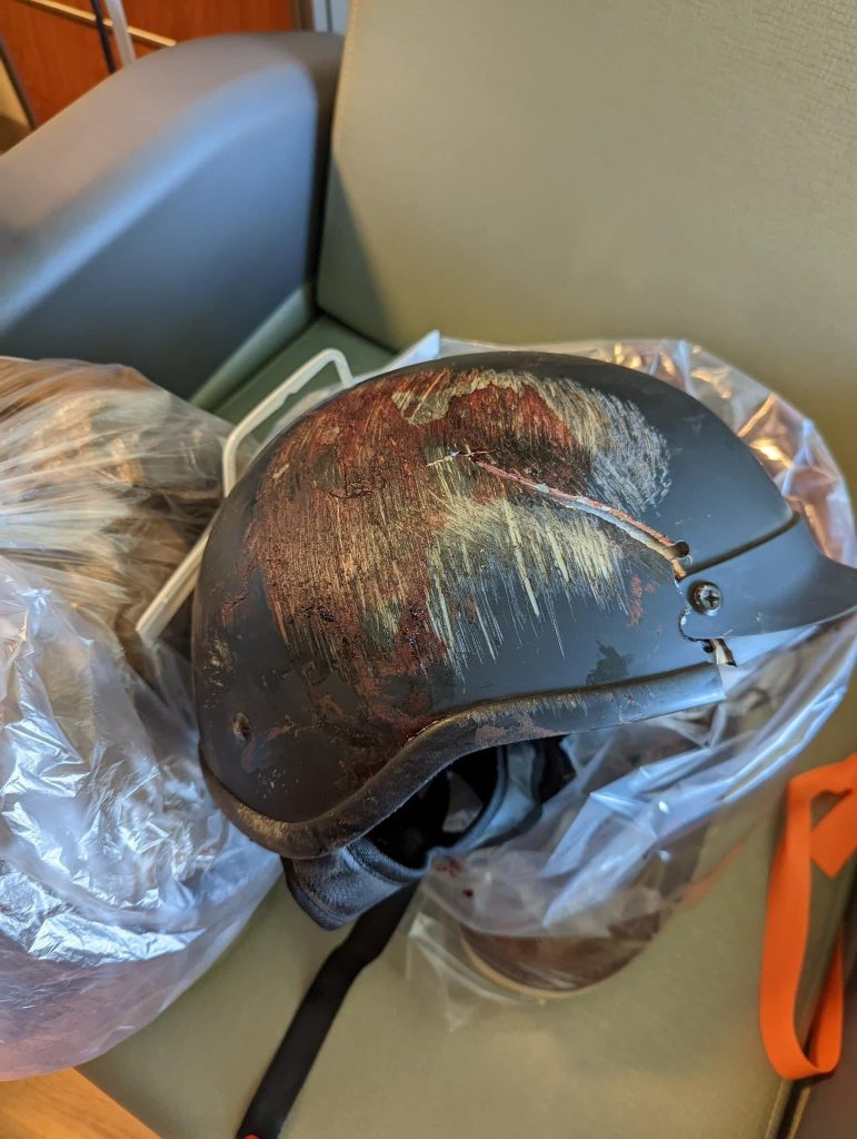 How Long Does a Bike Helmet Last