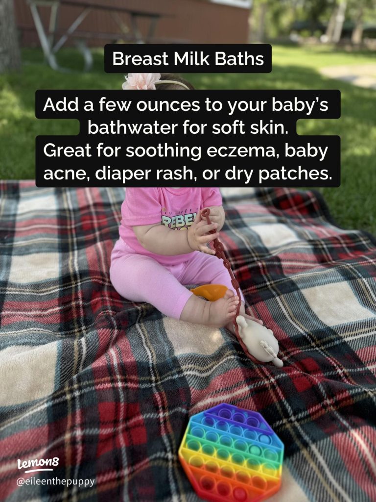 How to Make Diaper Rash Cream With Breast Milk