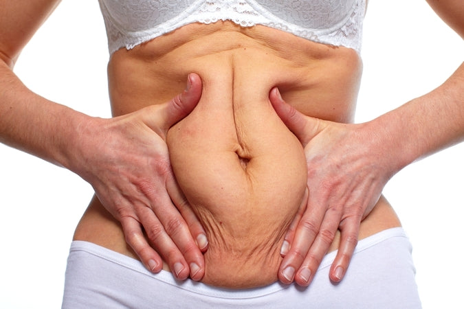 How to Tighten Postpartum Belly Skin