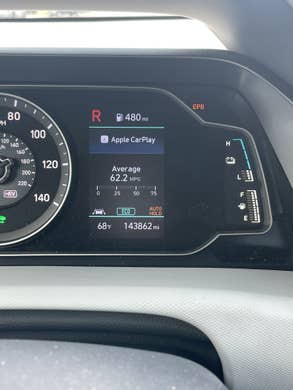 What Is Epb On Hyundai